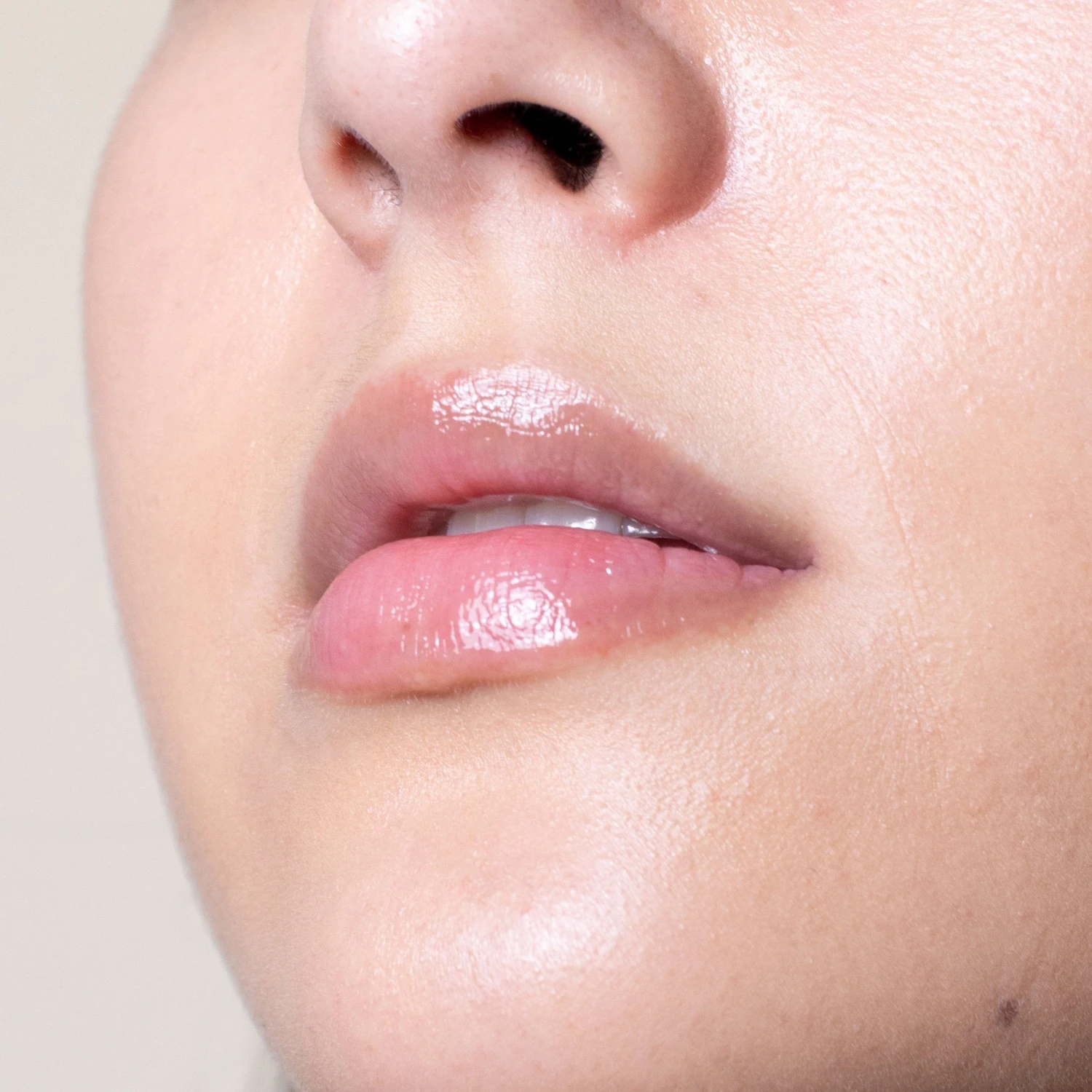 Lip Therapy - Image 5