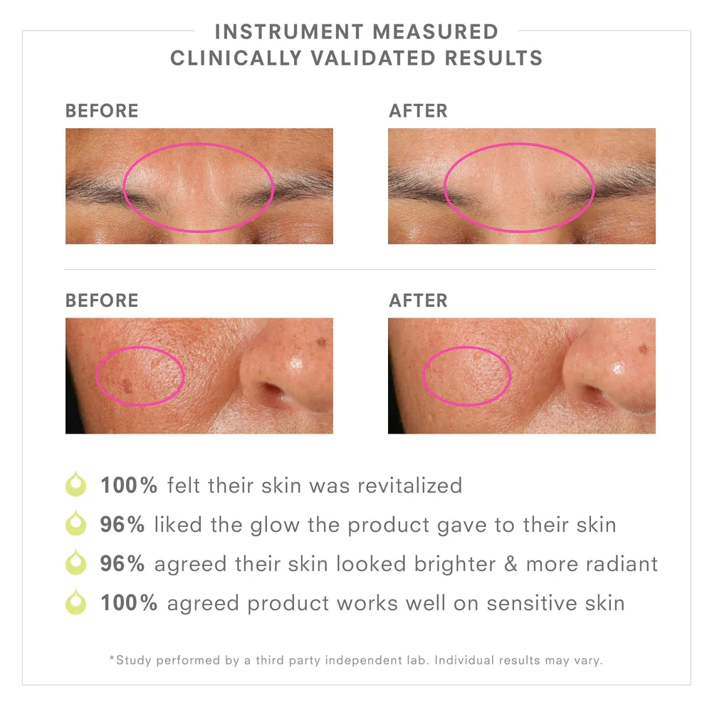 PREBIOTIX™ Freshly Squeezed Glow 20% Vitamin C Serum - Image 5