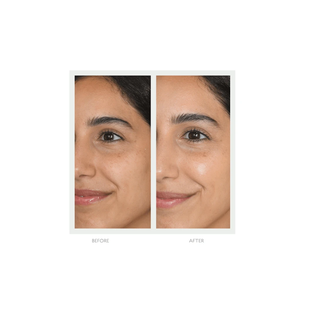 Resurfacing Mask - Image 7